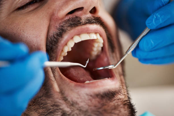 Best Emergency Treatment for Oral Infections in Und City, MO