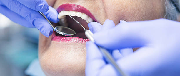 Best Emergency Wisdom Tooth Extraction in Und City, MO